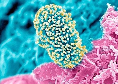 Изображение бактерии под микроскопом. 