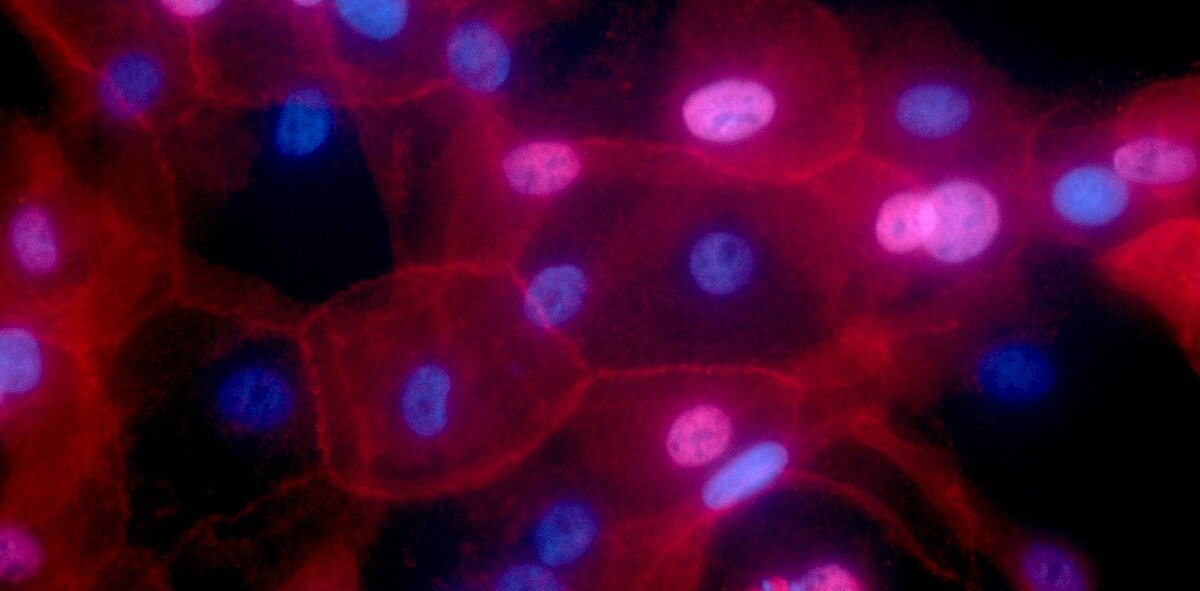 Клеточная культура рака молочной железы. Красным флюоресцирует главный комплекс гистосовместимости, в составе которого может презентироваться HER2, синим – клеточные ядра. © CC BY-NC 2.0/Ewa Krawczyk, NIH