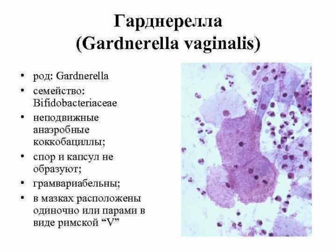 Гарднереллез: причины, симптомы, лечение