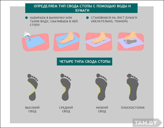 Как определять стопы. Как определять стопы. Поперечное плоскостопие отпечаток стопы. Типы пронации стопы. Плоскостопие пронация стопы.