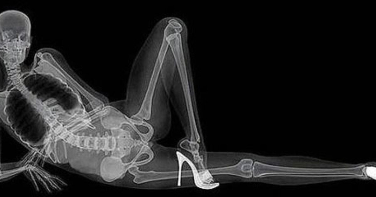 Взято из общего доступа в интернете