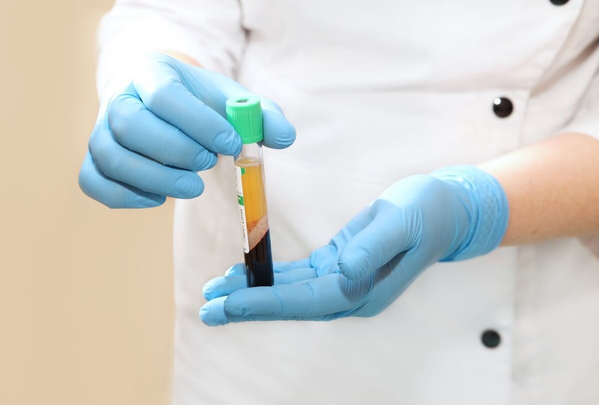 Пробирка с вашей кровью после центрифуги 