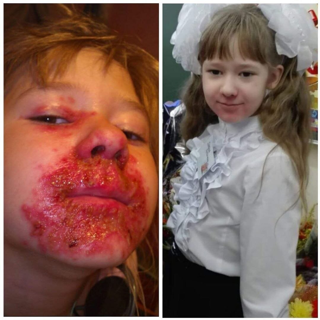 #восстановлениездоровья 