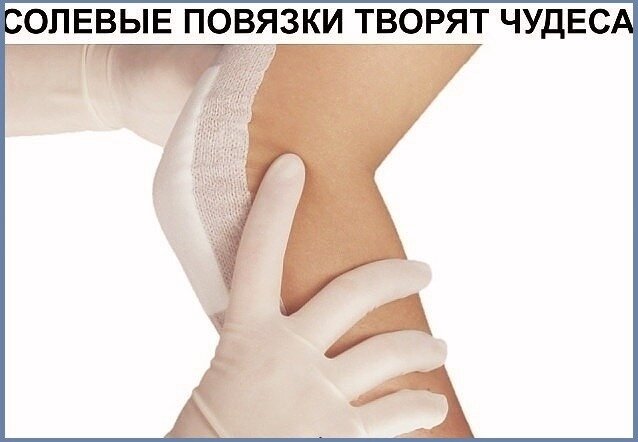 А ВЫ ЗНАЕТЕ, ЧТО СОЛЕВЫЕ ПОВЯЗКИ ТВОРЯТ ЧУДЕСА? 