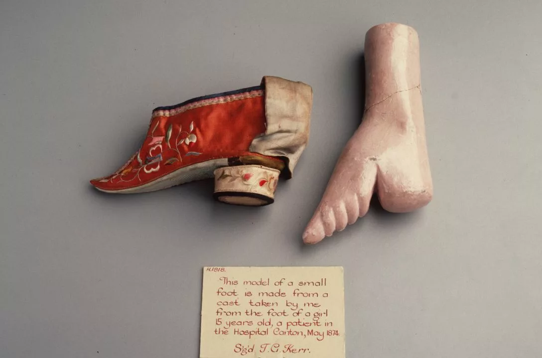 Знаменитая "ножка лотоса". Источник изображения открытая база "Яндекс. Картинки".