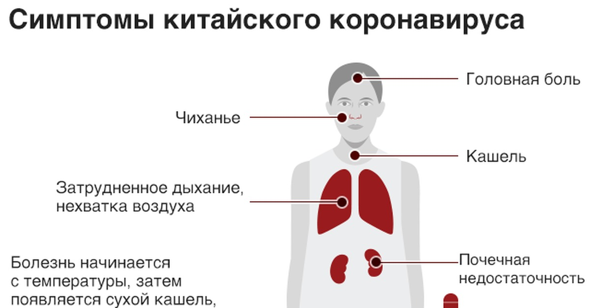 Заболеть после ковид. Основные симптомы коронавируса у человека. Признаки клрооовирусп. Признаки короны. Признаки короноваоису.