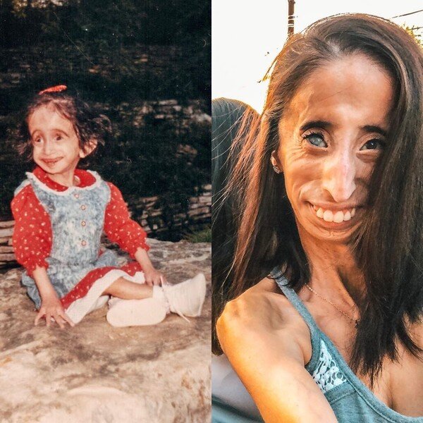 Лиззи в детстве и сейчас. Фото: @littlelizziev