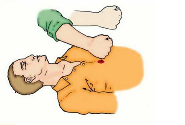 При отсутствии сердцебиения. Непрямой массаж сердца при утоплении. Наружный непрямой массаж сердца. Техника нмс непрямой массаж сердца. Непрямой массаж сердца при электротравме.