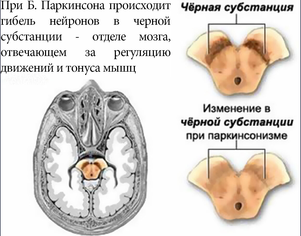 Марк Жолондз: Рак: практика исцеления и профилактика. Лечение ядами