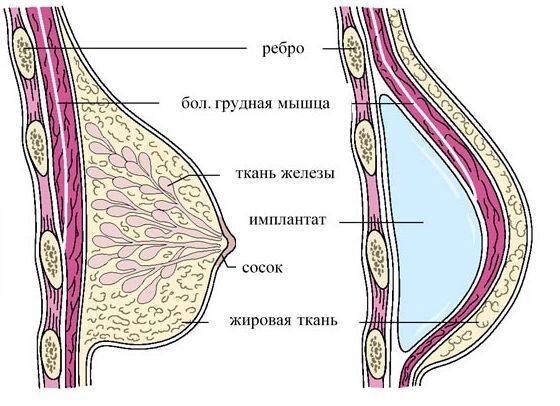 Большая натуральная грудь