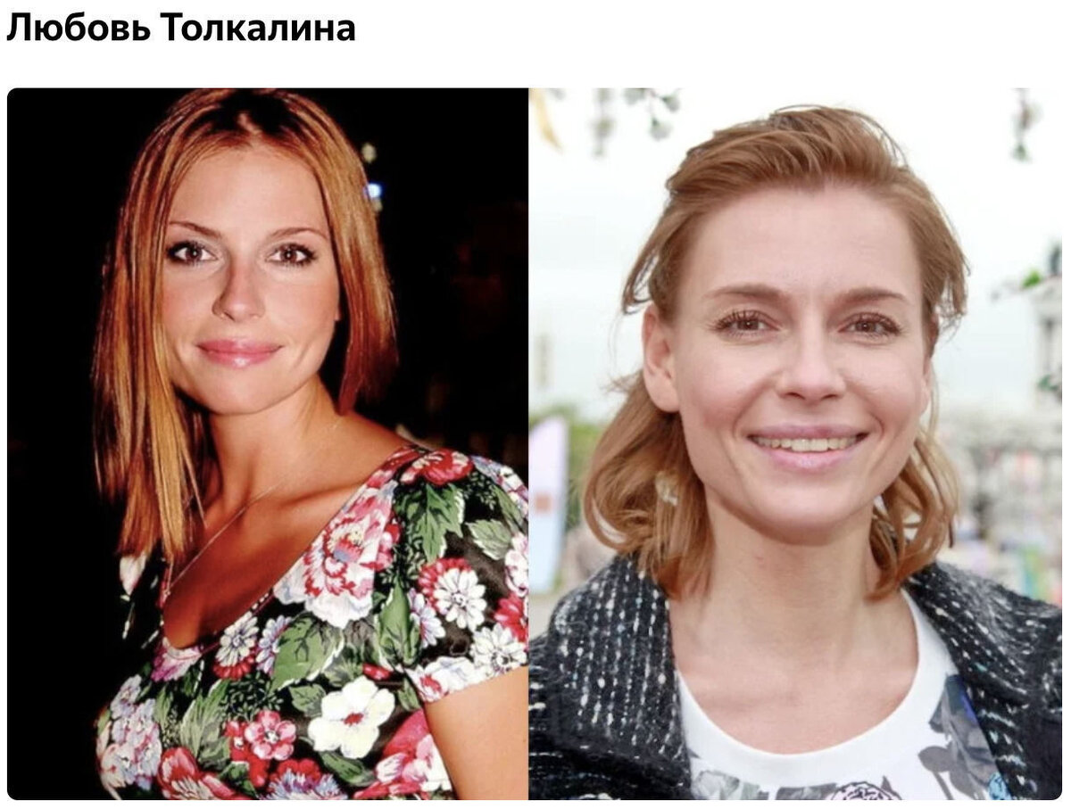 Любовь толкалина пластика до и после