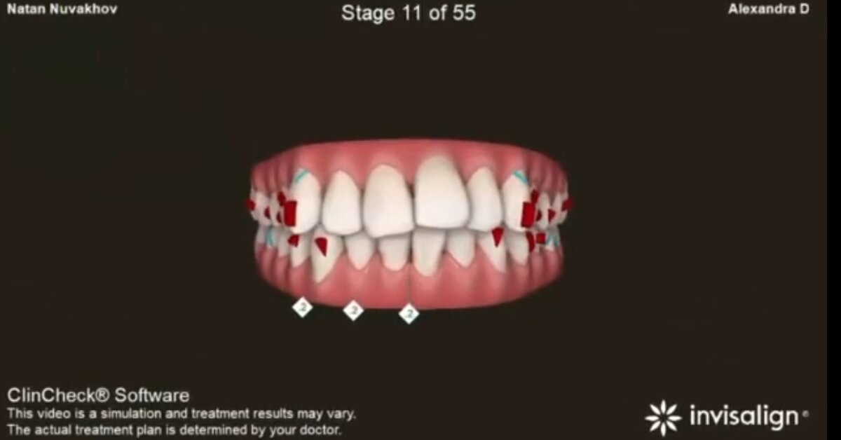 Источник https://www.instagram.com/dental_doctor_martin/ 