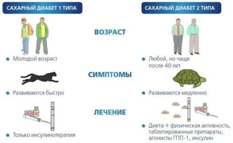 Отличия не только в механизме развития