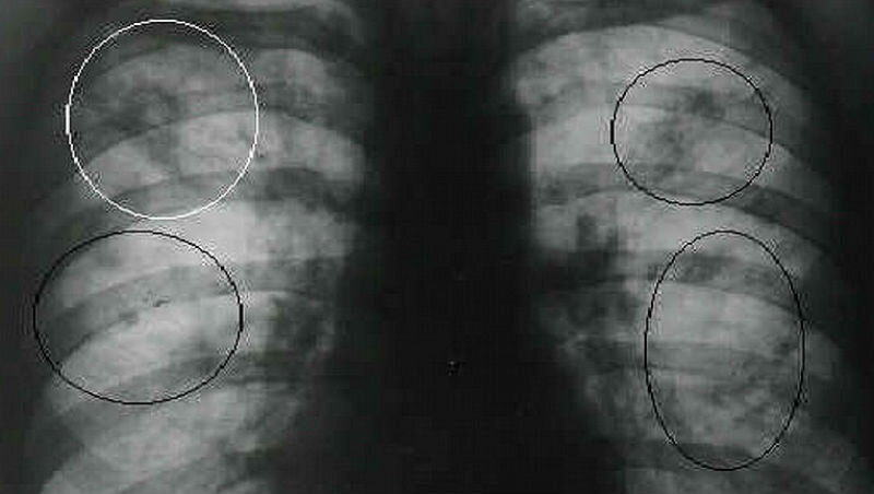 фото: Moydiagnos.ru