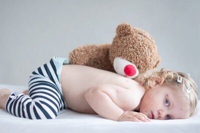 Самый пик заражения ветрянкой приходится на возраст 4-7 лет, но более врослые дети, а также груднички не защищены от поражения этой инфекцией