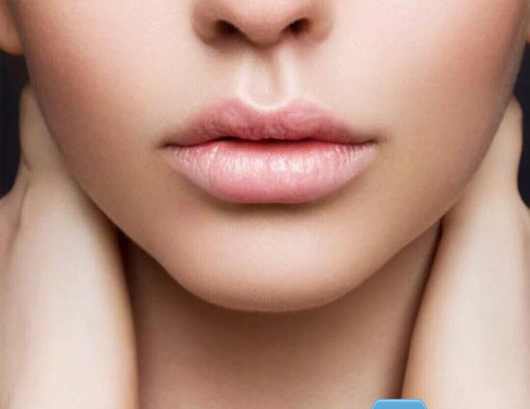 Филлеры на основе гиалурлновой кислоты уже является старой и проверенной процедурой контурной пластики. С помощью них можно увеличить Губы,увлажнить кожу ,поднять скулы и выровнять носогубную складку. В течении года гиалуроновая кислота увлажняет кожу,разглаживая дополнительно морщинки,филлер расщиплятся и выводится естественным путём. Поэтому действие филлера ограничено примерно годом.зависит от качества препарата, Филлер предназначен для заполнения морщин и восполнения объема там где его с возрастом начинает не хватать.а когда ткани провисают.обьем исчезает в средней трети лица-скулы.например. Но поскольку гиалуроновая кислота притягивает воду с филлерами нужно быть осторожнее.не больше 2мл.в год.так как может вызвывать не нужный отек.поэтому лучше обращаться к специалисту -косметологу и лучше с хорошим опытом работы.не менее 7лет. Я назову эту процедуру по истине волшебной.потому что моментально и надолго обеспечивает результат.которого не добиться даже еженедельными массажами лица👍 Конечно это не освобождает от профессиональных процедур.хотя бы раз в месяц.для поддержания здоровья и красоты кожи и правильного домашнего ухода. Поскольку верхние слои дермы нуждаются в отшелушивании,увлажнении и питании. Будьте любимы всегда😊