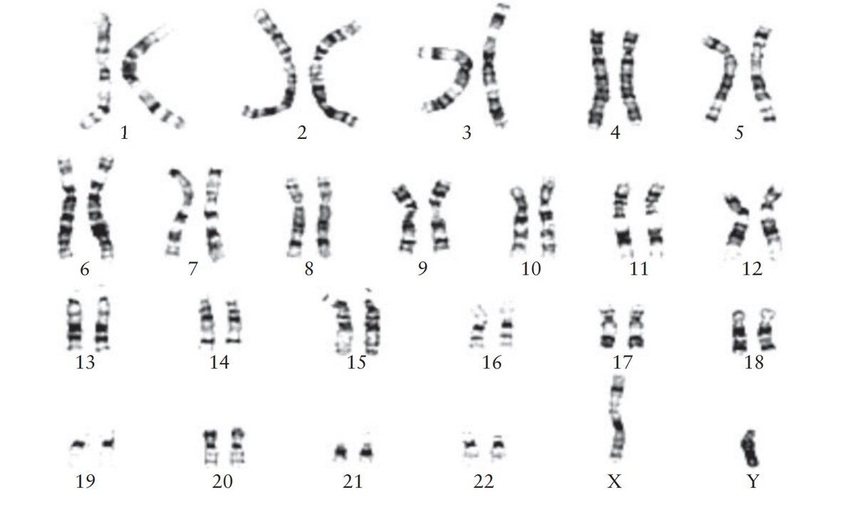 Рисунок 1. Кариограмма мужчины. Источник: doi:10.1128/9781555818890.ch3.f3.1