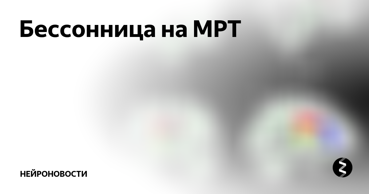 Бессонница на МРТ | Нейроновости | Дзен