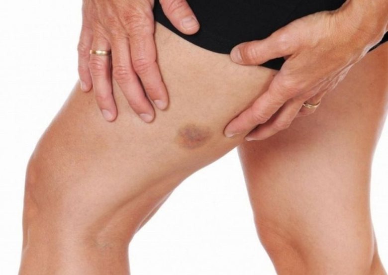  7 основных причин появления 