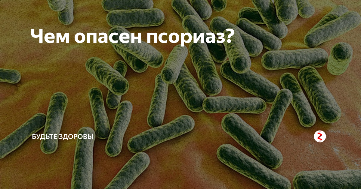 Как проявляется псориаз. Пустулезная форма псориаза.