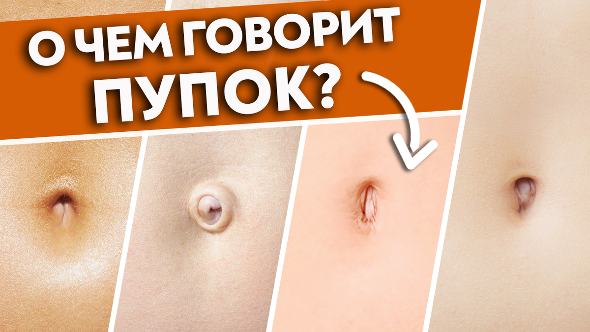 Омфалит у взрослых лечение консультация в экспертной клинике ID-CLINIC Санкт-Петербург