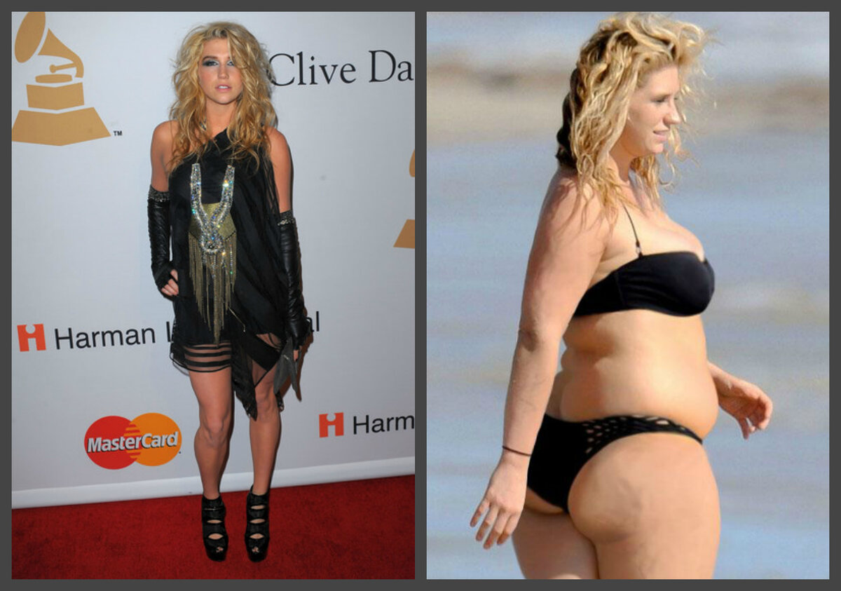 Певица Кеша