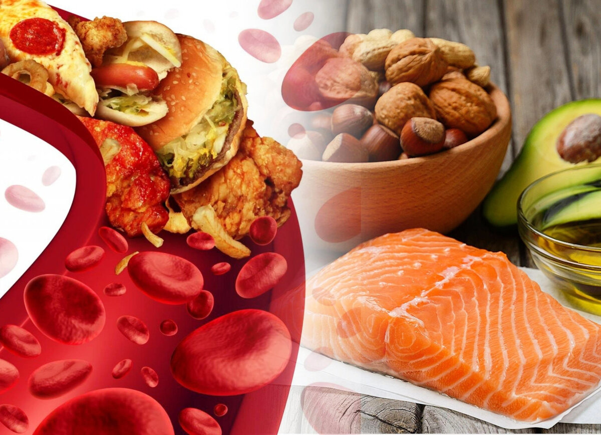 Какие продукты повышают холестерин