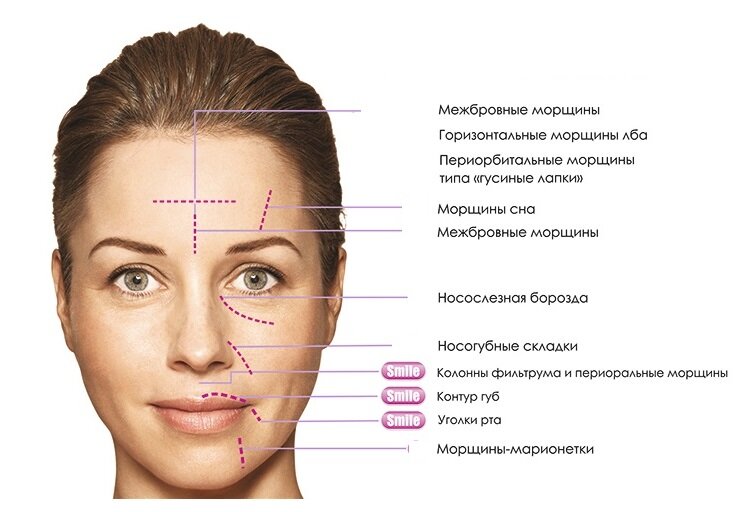 Морщины: как убрать, виды, косметология и домашние методы