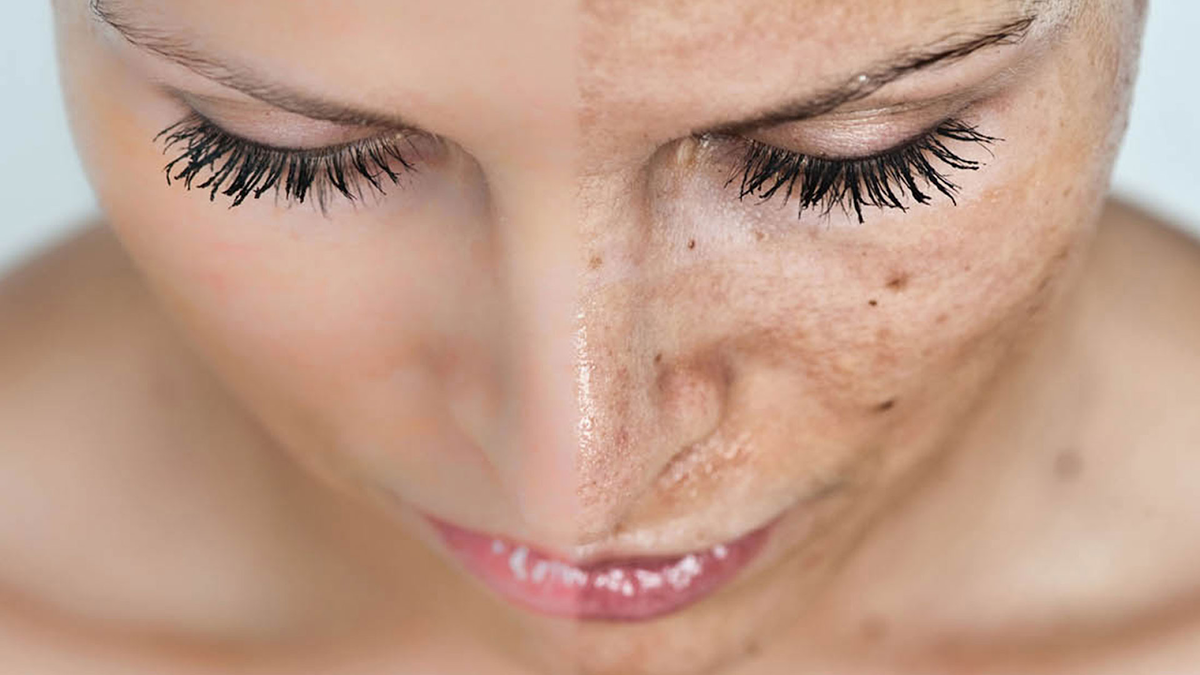 Хочется чистую и однотонную кожу. В жизни чаще бывает иначе...