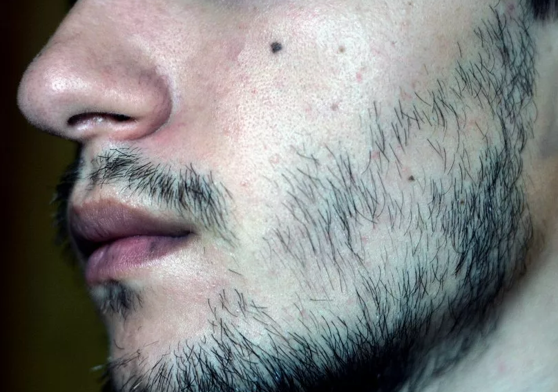 Фотография взята из источника yandex.ru