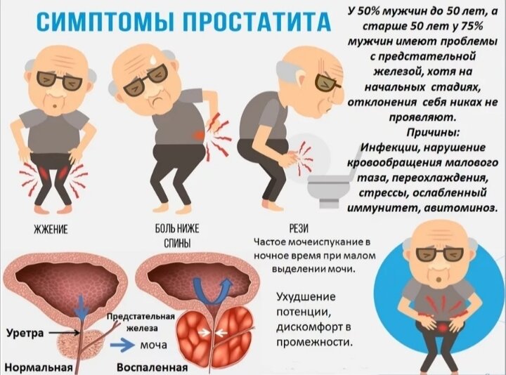 Простатит симптомы и последствия. Простатит симптомы и последствия