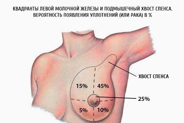 Фото с сайта https://m.ilive.com.ua/health/kvadranty-molochnoy-zhelezy_109718i16015.html