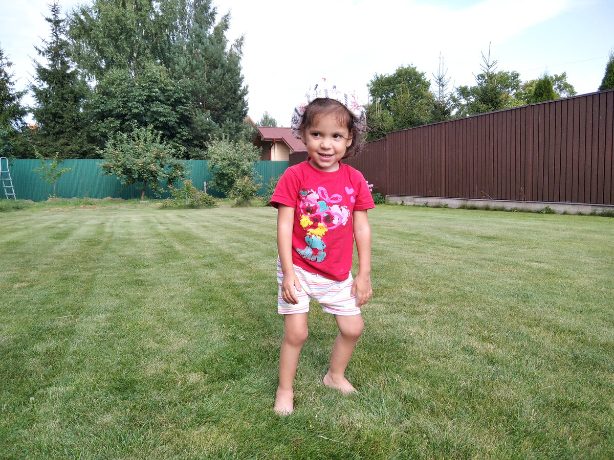 Каролина за месяц до лечения. Ноги отекшие в коленных и голеностопных суставах. Она еле стоит на ногах. 