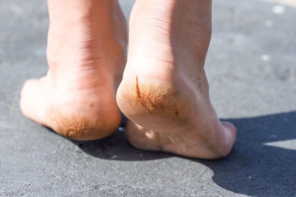 источник sveikata.lrytas.lt