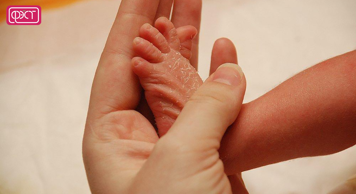 Почему у новорожденных странная кожа?