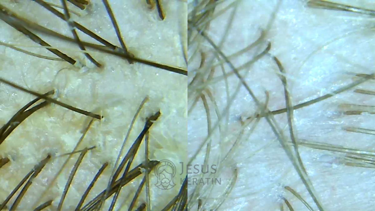 Слева – плохо очищенная кожа головы. Справа – хорошо очищенная 