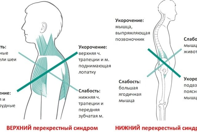 Почему болит поясница? 