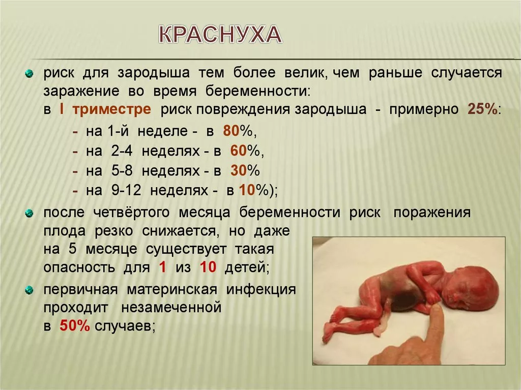 Краснуха, Rubella virus, антитела IgG