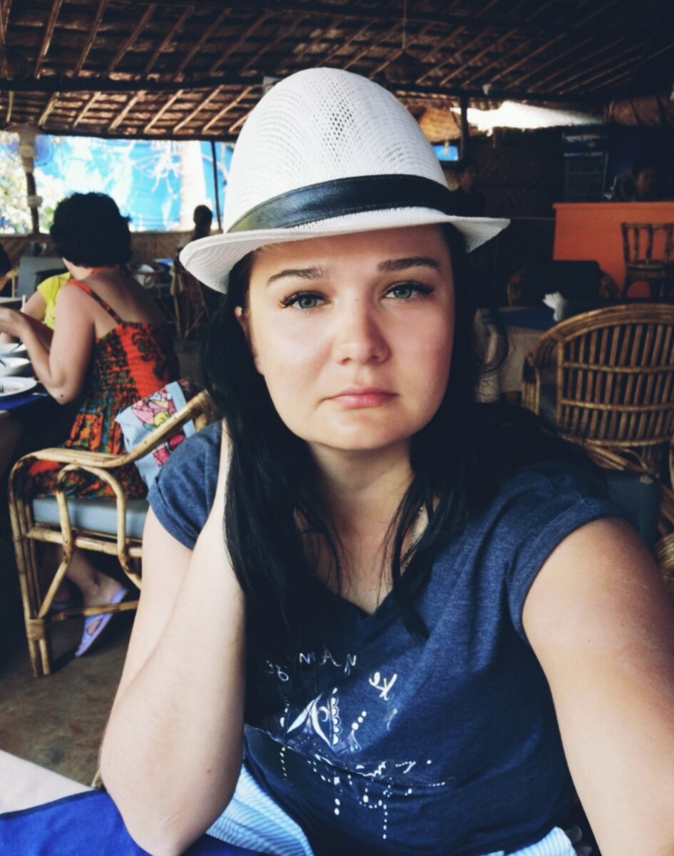 Сижу, жду еду с обгоревшим лицом 