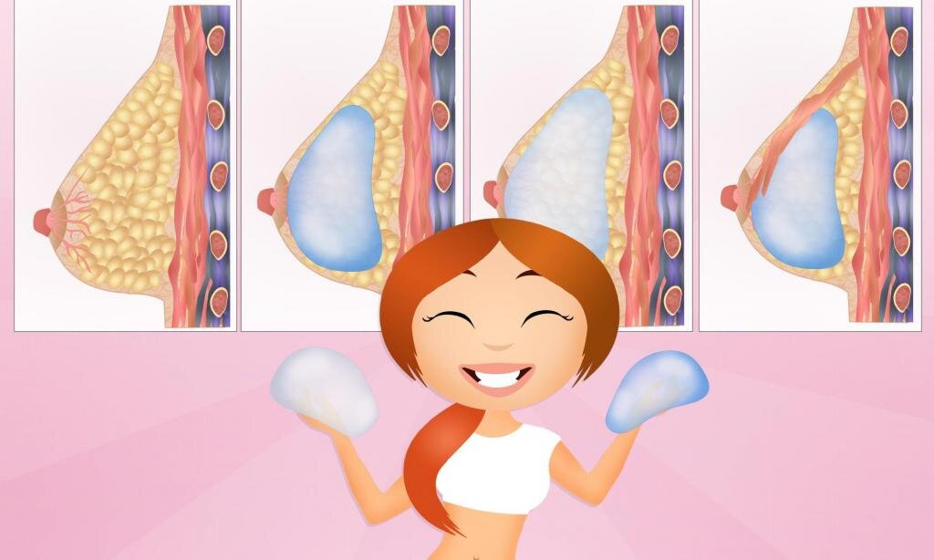 Фото: longislandbreastsurgery.com