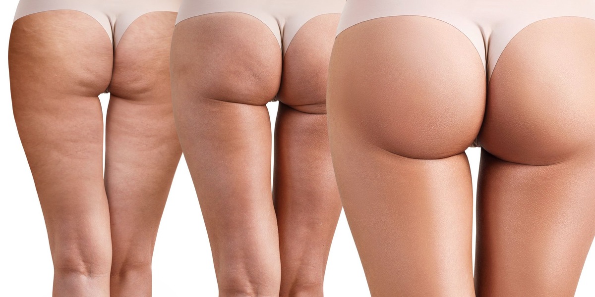 Источник фотографии Яндекс картинки