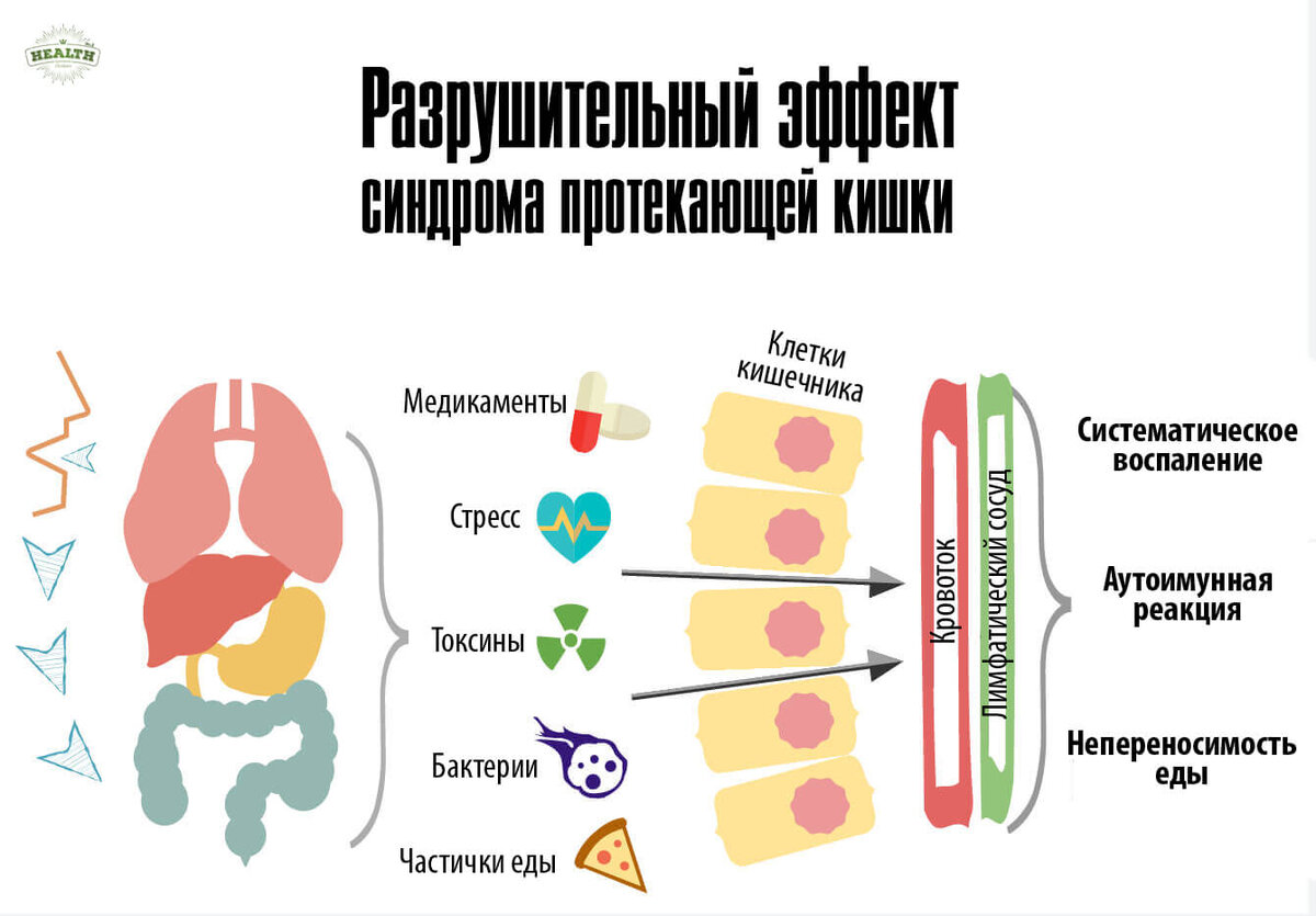 В организме протекающего в. Синдром повышенной кишечной проницаемости. Синдром дырявого кишечника. Последствия синдрома дырявого кишечника. Синдром кишечной проницаемости симптомы.