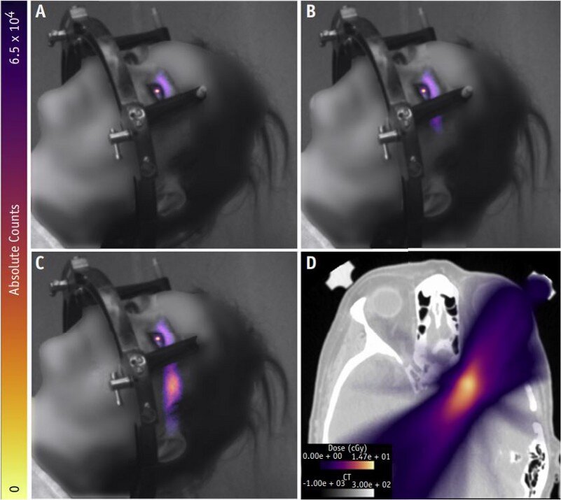 Источник: https://www.redjournal.org/action/showPdf?pii=S0360-3016%2819%2933947-1&fbclid=IwAR0l5I4eO7wdqxGjYZDBkMRBor5RXtMzdkdq4meWEZoE7BGBBcSD8ztnbsY
