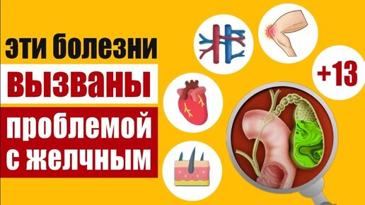 Download Video: 17 болезней, которые вызывает неправильная работа желчи