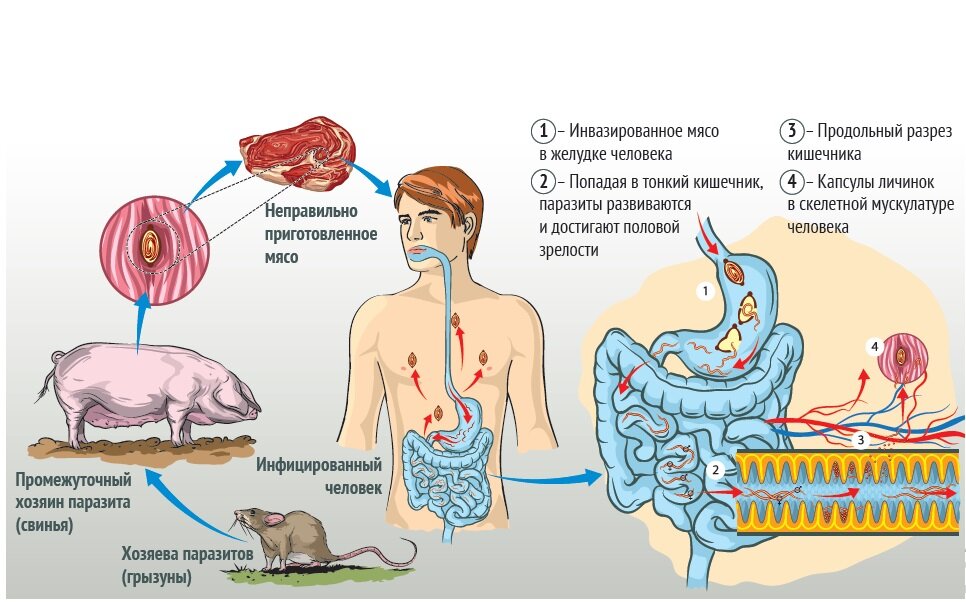 Цикл развития трихины кратко схема