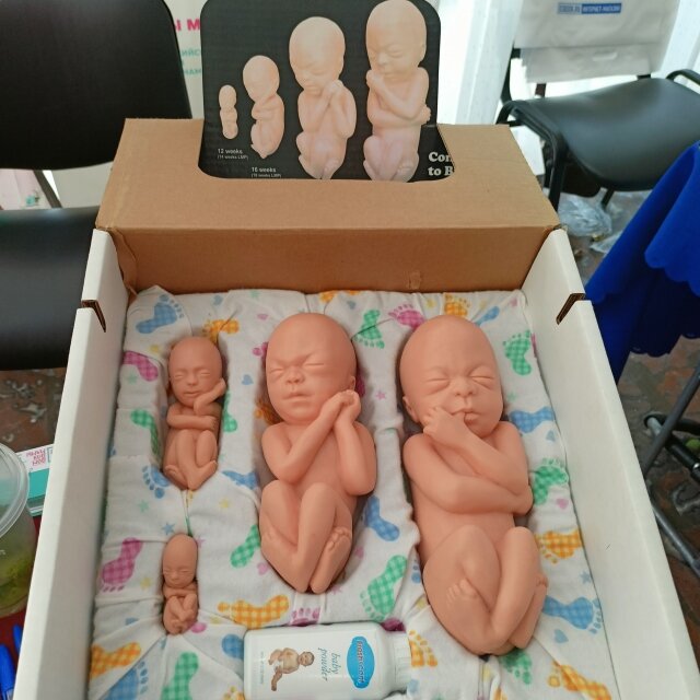    Такие муляжи развивающихся плодов показывают женщинам на доабортном консультировании. Подержав в руке или даже просто взглянув на 12-недельный плод, который выглядит как настоящий, только маленький человечек, каждая четвертая женщина отказывается от аборта. Фото предоставлено Институтом непрерывного медицинского и фармацевтического образования Волгоградского государственного медицинского университета