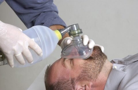  Искусственная вентиляция легких при инсульте и инородном теле в дыхательных путях