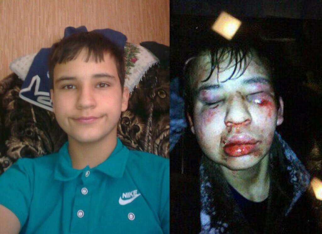 Кирилл до и после драки