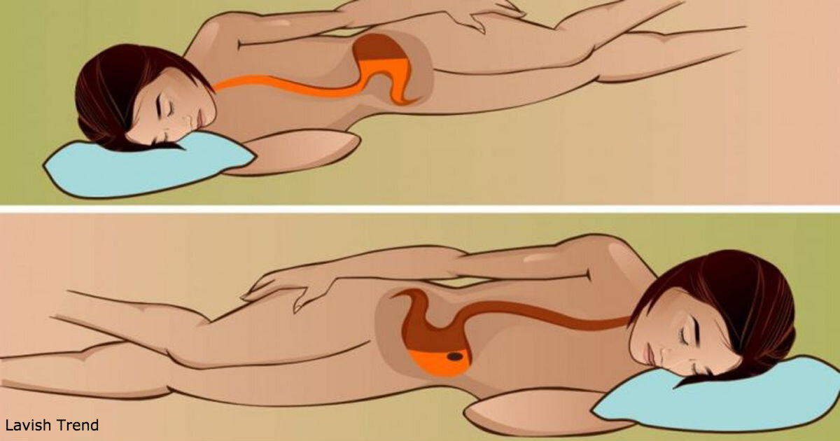 Спать на левом боку. Сон на левом боку сон. Правильная поза для сна на боку. Спать на левом боку желудок.