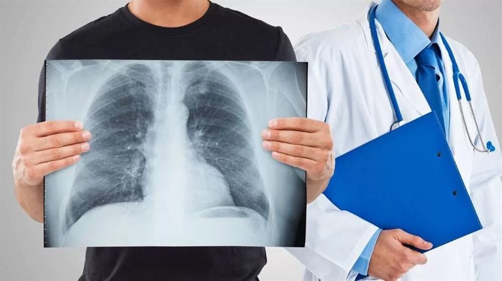 Каждому призывнику должны провести флюорографию